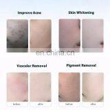 Wholesale 7 Color PDT LED Skin Care Facial Acne Removal Led Light Therapy Beauty Machine With Hot and Cold Stream Spray thumbnail-5