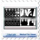 EdgeLight Slim Medical Film Viewer