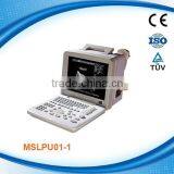 Portable diagnostic ultrasound system MSLPU01P