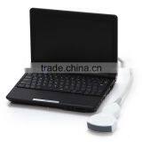 Hot Sale Black Color 10.1-inch High-resolution TFT LCD Portable pc Ultrasound Machine for Scan thumbnail-5
