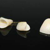 Dental Crown E.Max Ceramic, Porcelain Crown, Dental Veneers, Laboratoire Dentaire, Dentallabor, Laboratorio Dental, Dental Laboratory, Shenzhen LJ Dental Lab China thumbnail-3