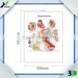3D Plastic Medical Wall Posters, Customized 3D Anatomical Charts thumbnail-4
