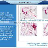 5 In 1 Cavitation Machine Beauty Equipment 1-10 Continuously Adjustable Cavitation Slimming Machine Ultrasonic Ultralift Hifu Skin Lifting thumbnail-6