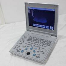 SS-6B Laptop All-Digital Ultrasound thumbnail-1