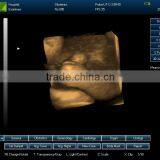 Portable Ultrasound Machine CU18A Made by Latest Color Ultrasoun Technology thumbnail-2