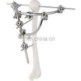 Guaranteed Quality Semi-circular External Fixator Orthopedic Surgical Implant thumbnail-6