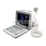 China Medical Ultrasonic Equipment pc Based Usb Ultrasound Scanner With Cheap Price thumbnail-3