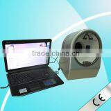2014 High Quality !portable Portable Skin Analysis Machine thumbnail-1