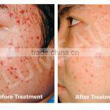 Colorful LED Phototherapy Light Therapy Facial Skin Spa Equipment thumbnail-3