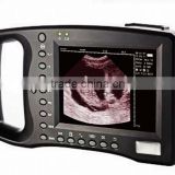 Pig pregnancy ultrasound scanner with palm (Futai-2000AV)