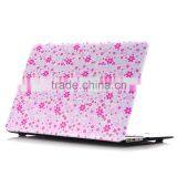 New Ideas 2016 Laptop Case Plastic Protective Sleeve for Macbook thumbnail-3