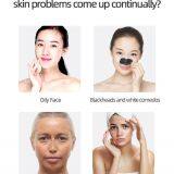 Multi-Function USB Charging Silicone Cleansing Instrument Ultrasonic Electric Facial Cleansing Brush thumbnail-2