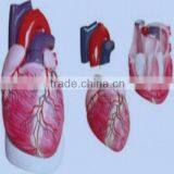 Anatomy Amplification Model of Heart for Medical and Teaching Use