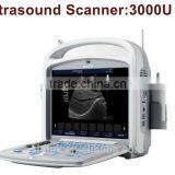 Super LINK Supply Digital Portable Ultrasound Scanner thumbnail-6