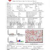 2015 New Best Sperm Analysis System With Factory Price thumbnail-6