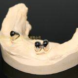 Dental Telescope Denture, Telesope Crown, Dental Prosthesis, Laboratoire Dentaire, Dentallabor, Laboratorio Dental, Dental Laboratory, Shenzhen LJ Dental Lab China thumbnail-2