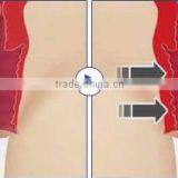 High Quality!!! Vaginal Tighten Hifu Equipment /vaginal Rejuvenation Hifu thumbnail-4