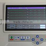 Carejoy CE ISO PC Analysis Software Resting 12 Lead Touch Screen 6 Channel Digital Electrocardiograph ECG Machine thumbnail-3