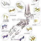 Orthopedic Locking Plates for Fixation of Mini Bone Fractures thumbnail-2