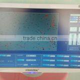 High Quality Sperm Analysis System With Low Price thumbnail-5