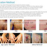 Home Tattoo Laser Machine Medical Laser 1 HZ Tatoo Removal Brown Age Spots Removal thumbnail-4