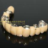 Dental Crown Composite, Dental Teeth, Dental Prosthesis, Laboratoire Dentaire, Dentallabor, Laboratorio Dental, Dental Laboratory, Shenzhen LJ Dental Lab China thumbnail-2