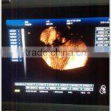 (MSLCU18)3D 4D Handheld Color Doppler Medical Ultrasound Scan Machine thumbnail-4