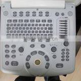 New Type Laptop Color Doppler Ultrasound for Human With Laptop thumbnail-4