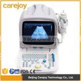 Beautiful Compact Diagnostic Ultrasound Probe / Mini Ultrasound Machine / Portable Ultrasound Scanner thumbnail-1