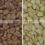 Color Sorter in China Bean Sorting Machine thumbnail-3