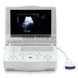 New Laptop Ultrasound Scanner for Abdominal, Cardiology, Gynecology, Obstetrics and Urology thumbnail-2