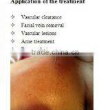 Last Price Portable Spider Vein Red Blood Vessels Removal Machine thumbnail-5