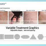 USA Laser Vaginal Tighten Medical Use RF Fractional Co2 Laser thumbnail-2