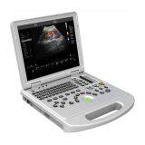 Portable 4D Color Doppler Ultrasound Scanner thumbnail-4