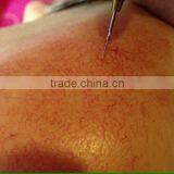 China Hair Salon Equipment Vascular Spider Vein Removal Machine thumbnail-5