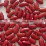 Red Kidney Bean/british Red Kidney Bean/dark Red Kidney Bean thumbnail-1