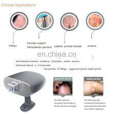 Sales New Style 308 Excimer Laser 308nm Psoriasis Vitiligo Laser thumbnail-4