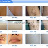 Germany Laser 808nm Hair Removal Machine With 4 in 1 Cooling System thumbnail-6