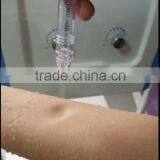 Acne Equipment Oxygen Facial Treatment Machine Facial Machine Hyperbaric thumbnail-6