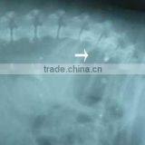 Fuji Dihl /medical Surgical Film/xray Medical Dry Laser Imaging X-ray Film thumbnail-1