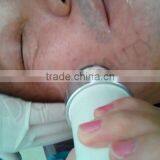 Skin Tightening Beauty Machine OD-R105 Face Lifting Portable rf Radio Frequency Facial Machine for Home Use thumbnail-3