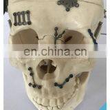 Pure Titanium Preformed Orbital Plate, Small, Right, 0.4mm Thick thumbnail-6