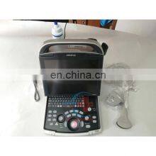 Good Quality Original Mindray DP-30 BW Portable Full Digital Ultrasound Machine Mindray DP 30 Ultrasound Machine thumbnail-3