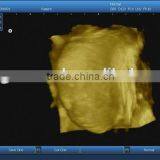 Professional Ultrasound Devices With 3d thumbnail-6