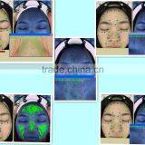 Mini Skin Analyzer Machine Gold Quantum Analyser thumbnail-5