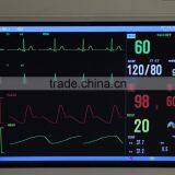8-inch 6-Parameter Patient Monitor With Low Price Ambulance Patient Monitor thumbnail-6