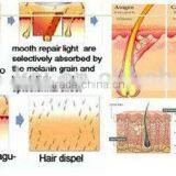 2015 New IPL SHR Elight Hair Removal Machine thumbnail-5