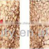 Sanhe SU-5 Faster Fat Freeze Body Shaping Cavitation Slimming System thumbnail-6