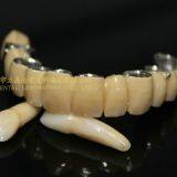 Dental Crown Composite, Dental Teeth, Dental Prosthesis, Laboratoire Dentaire, Dentallabor, Laboratorio Dental, Dental Laboratory, Shenzhen LJ Dental Lab China thumbnail-1