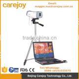 Electronic Colposcope Endoscope for Gynecology Gynaecological Vagina 800,000 Pixels With CCD Sony Camera by CE Certification thumbnail-1